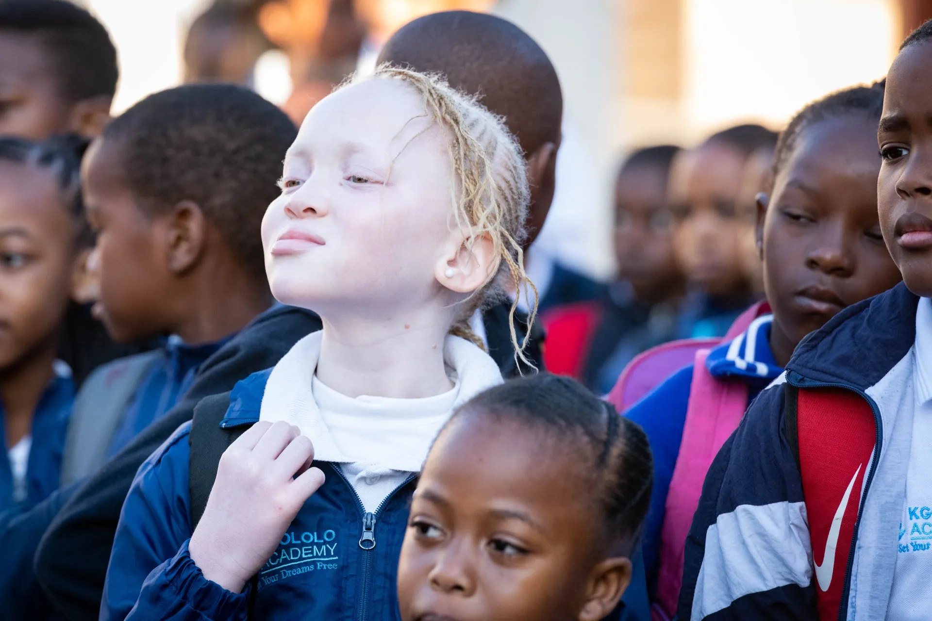 An albino student standing with her classmates at Kgololo Academy